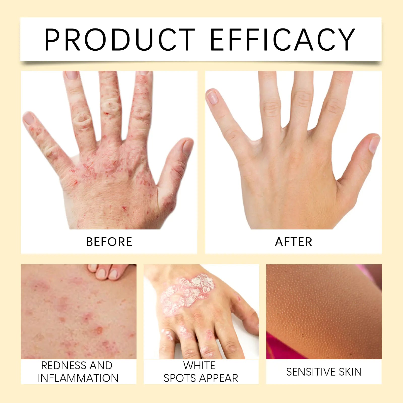 Bee White Spot Neck Cream Skin Repair