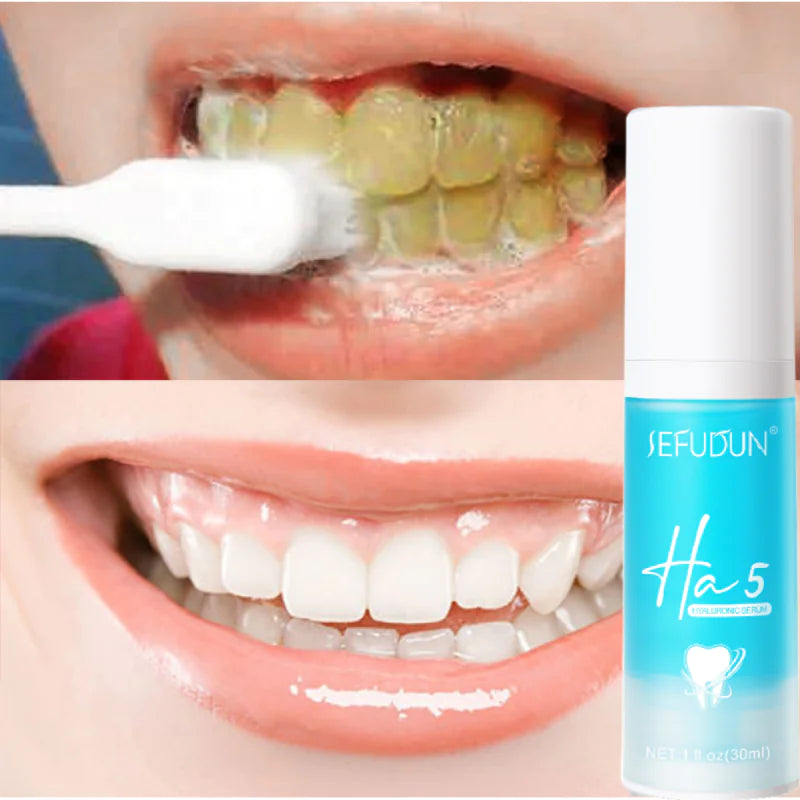 "Anti-Allergic Toothpaste for Fresh Breath and Enamel Care"
