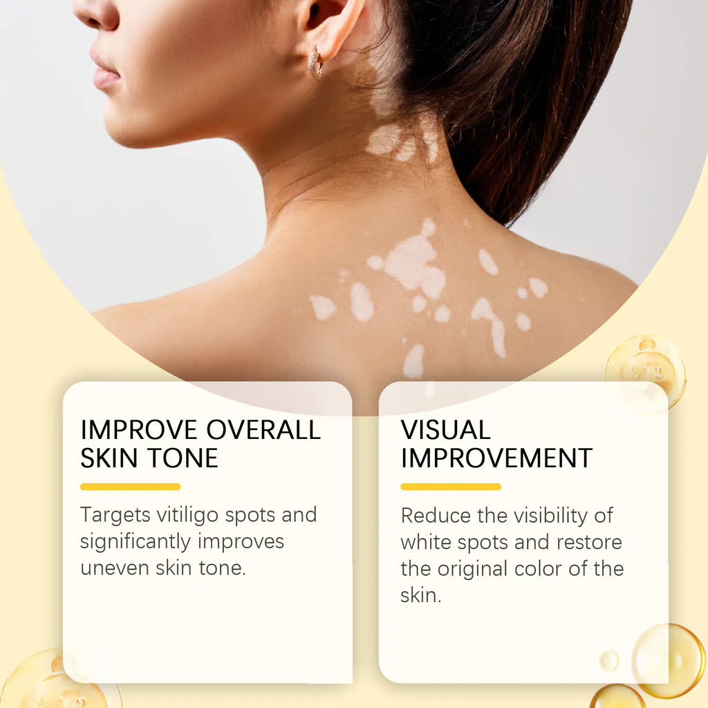 Bee White Spot Neck Cream Skin Repair